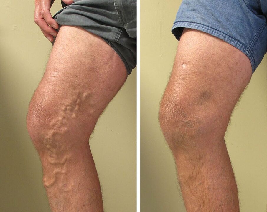 Experience using zxcvbnmqwert gel