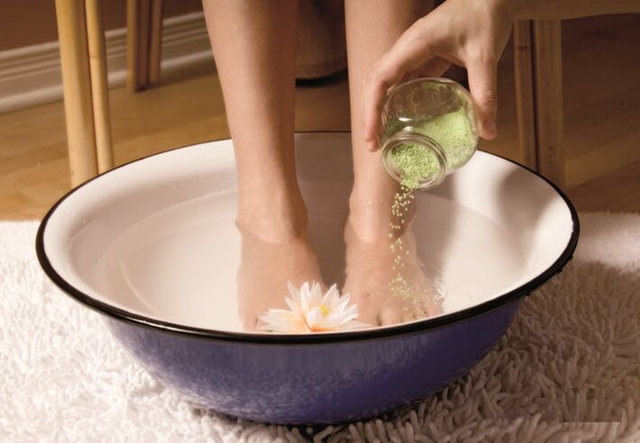 Varicose vein treatment