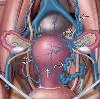 Change the structure of the vascular wall
