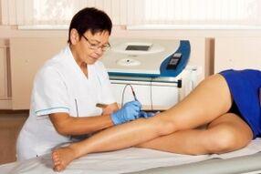 What is the varicose vein